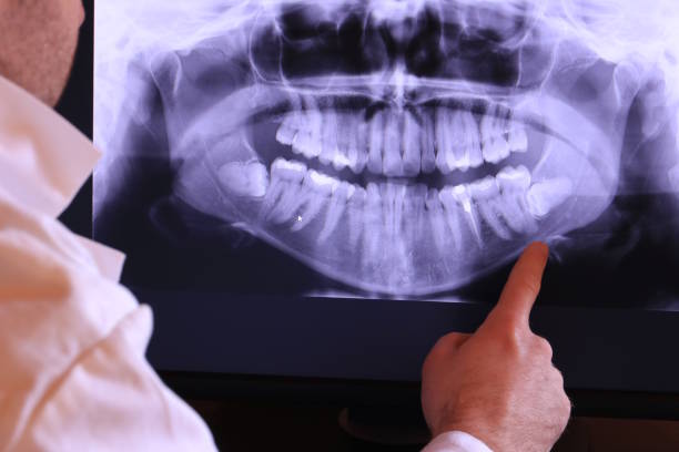 Best Orthodontic Emergency Dentist in Kentwood, MI
